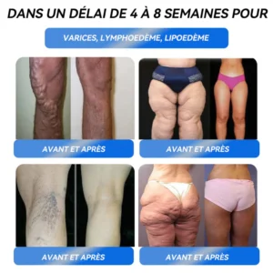 Solution orale pour la perte de poids - Image 13