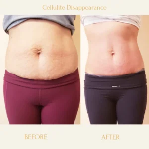 Anti-Cellulite Firming Soap - Image 3