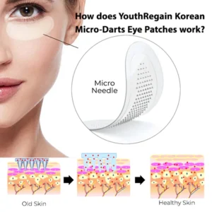 Korean Micro-Darts Eye Patches - Image 3