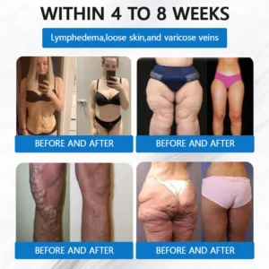 𝐂𝐨𝐥𝐥𝐚𝐠𝐞𝐧 𝐍𝐚𝐧𝐨 𝐌𝐢𝐜𝐫𝐨𝐧𝐞𝐞𝐝𝐥𝐞 𝐖𝐞𝐢𝐠𝐡𝐭 𝐋𝐨𝐬𝐬 𝐏𝐚𝐭𝐜𝐡 - Image 7