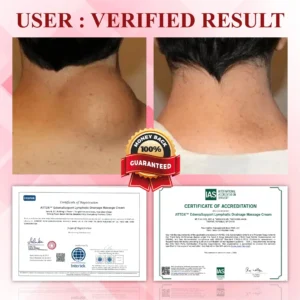 EdemaCare Lymphatic Drainage Massage Cream - Image 5