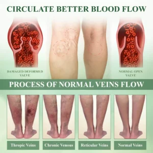 FluidEase Leg Therapy Edema Cream - Image 7
