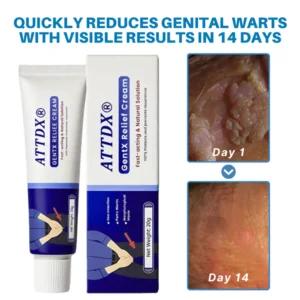 Warts Relief Cream - Image 3