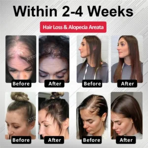 Hair Reawaken PP405 Roll-On Serum for Women 👩 - Image 5