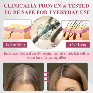 Hair Reawaken PP405 Roll-On Serum for Women 👩 - Image 7