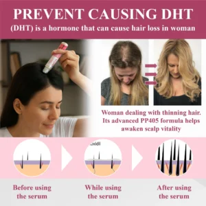 Hair Reawaken PP405 Roll-On Serum for Women 👩 - Image 8