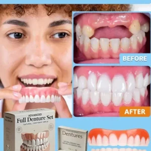 🦷Advanced Customized Full Denture Set🦷 - Image 9