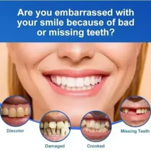 🦷Advanced Customized Full Denture Set🦷 - Image 4