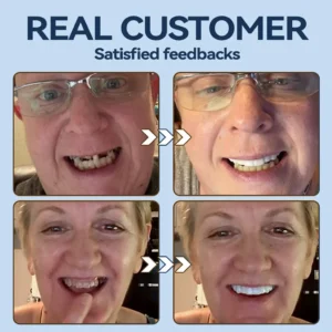 👧🏻🔆- 𝐏𝐫𝐞𝐦𝐢𝐮𝐦 𝐃𝐞𝐧𝐭𝐮𝐫𝐞- (✨Suitable for all mouth shapes, custom-made dentures for a perfect fit✨） - Image 8