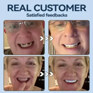 👧🏻🔆- 𝐏𝐫𝐞𝐦𝐢𝐮𝐦 𝐃𝐞𝐧𝐭𝐮𝐫𝐞- (✨Suitable for all mouth shapes, custom-made dentures for a perfect fit✨） - Image 8