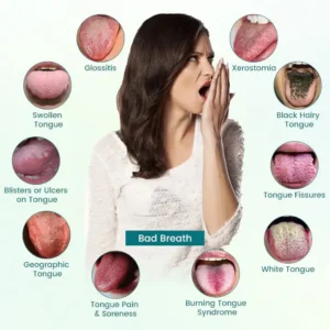 Tongue Repair Spray - Image 7