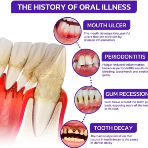 Bee Venom Dental Therapy Oral Power - Image 7