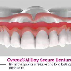 AllDay Secure Denture Bond - Image 7
