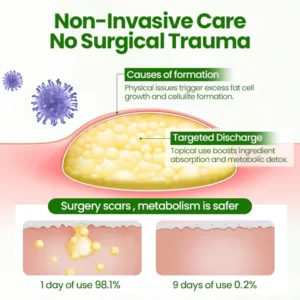 Lipoma Removal Cream - Image 5