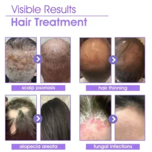 ✨👩‍🔬 Hair Root Repair Growth Drops - Image 3
