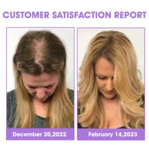 ✨👩‍🔬 Hair Root Repair Growth Drops - Image 5