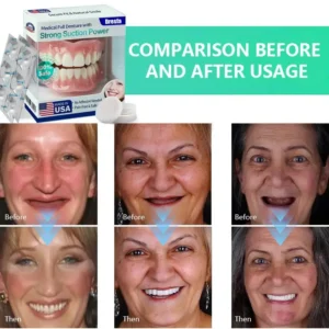 Full Denture with Strong Suction - Image 3