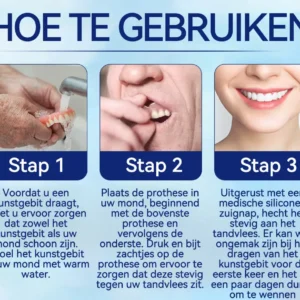 Geavanceerde op maat gemaakte volledige protheseset - Image 11