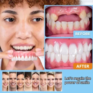 💝Premium Advanced Customized Full Denture Set 💝 (⏰Limited time discount last 30 minutes) - Image 7