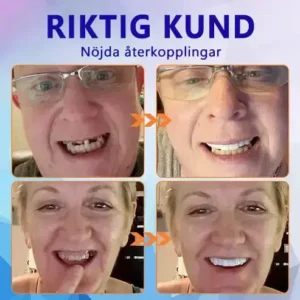 🧡Premium Avancerat Anpassat Helprotes-set 🧡 (⏰Tidsbegränsad rabatt i 30 minuter) - Image 2