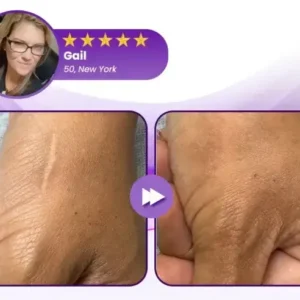 Face & Body Scar Gel - Image 10