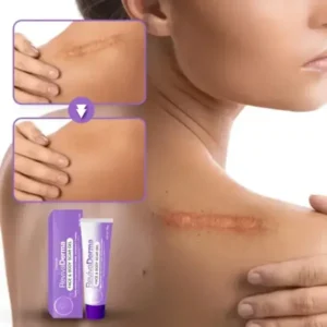 Face & Body Scar Gel - Image 8