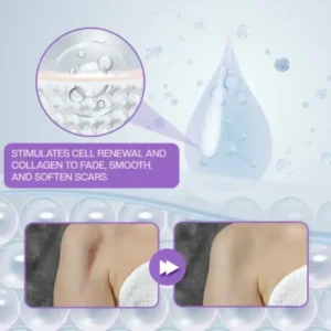 Face & Body Scar Gel - Image 9