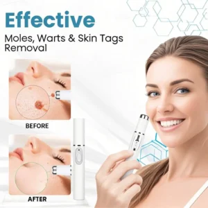 Non-Invasive Mole and Wart Removal Laser Pen - Image 5
