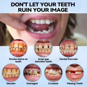 Silicone Reline Denture Set - Image 6