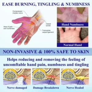 NumbAway CoolEase Neuropathy Spray - Image 7