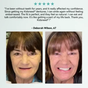 𝐇𝐲𝐝𝐫𝐨𝐒𝐡𝐚𝐩𝐞 𝐓𝐡𝐞𝐫𝐦𝐨-𝐀𝐝𝐚𝐩𝐭𝐢𝐯𝐞 𝐒𝐦𝐚𝐫𝐭 𝐅𝐮𝐥𝐥 𝐃𝐞𝐧𝐭𝐮𝐫 - Image 7