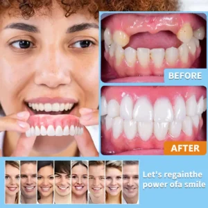 Custom-Fit Functional Dentures - Image 8