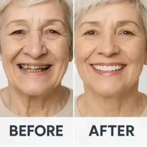 Custom-Fit Functional Dentures — ComfortMax Edition - Image 12