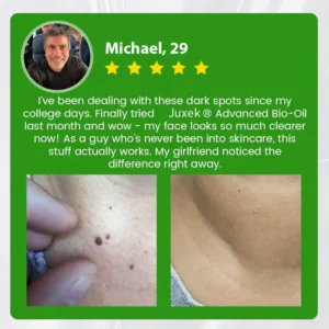 Advanced Bio-Oil Mole Spot Corrector - Image 8