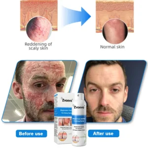 Magnesium Herbal Spray - Image 7