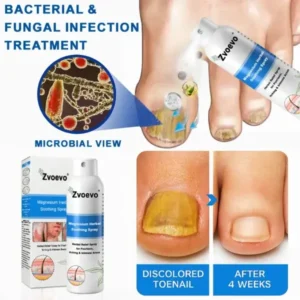 Magnesium Herbal Spray - Image 8