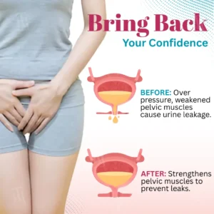 Bladder Control Patch - Image 4