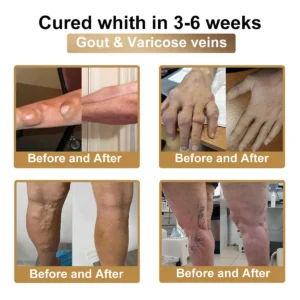 Bee Venom & Botulinum Toxin Joint Pain Relief & Repair Cream– Fast Relief & Joint Repair - Image 6