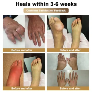Bee Venom & Botulinum Toxin Joint Pain Relief & Repair Cream– Fast Relief & Joint Repair - Image 7