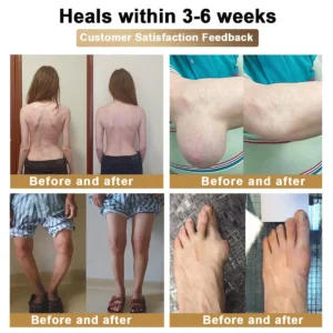 Bee Venom & Botulinum Toxin Joint Pain Relief & Repair Cream– Fast Relief & Joint Repair - Image 8
