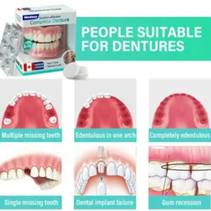 Suction-fit Complete Denture - Image 6