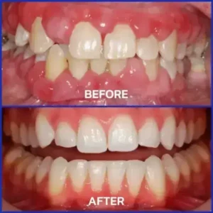 VioCore Bee Venom Dental Treatment Toothpaste - Image 6