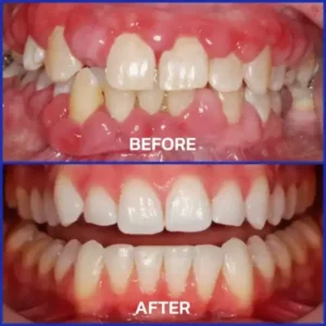 Bee Venom Dental Treatment Toothpaste - Image 6