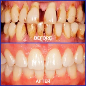 VioGloss Bienengift-Zahntherapie Oral Power - Image 3