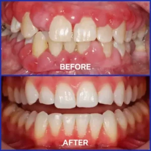 Bienengift-Zahntherapie Oral Power - Image 6
