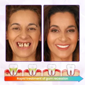 Advanced Gum Healing Toothpaste - Image 10