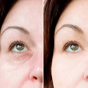 Eye Roller for Puffiness - Image 4