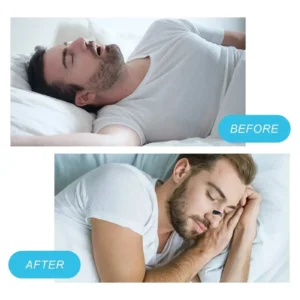 Nasal Breathing Dilators - Image 8