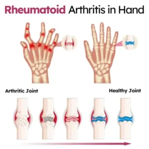 Advanced Joint & Bone Renewal Cream - Image 11