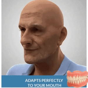 Advanced Custom-Fit Functional Dentures - Image 8